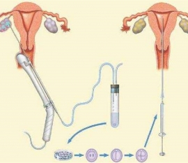 35岁女性备孕请做好以下检查，“健康深圳代生宝宝”跑不远